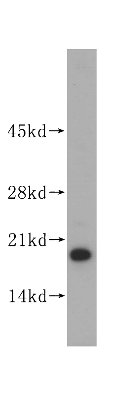 mouse heart tissue were subjected to SDS PAGE followed by western blot with Catalog No:111936(ISCU antibody) at dilution of 1:500