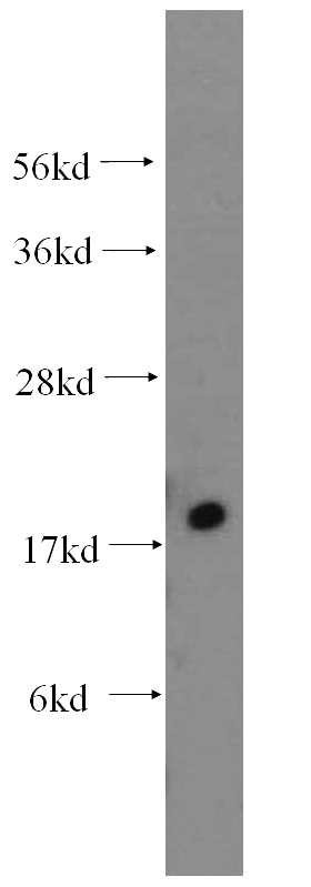 human brain tissue were subjected to SDS PAGE followed by western blot with Catalog No:112968(MYL5 antibody) at dilution of 1:500