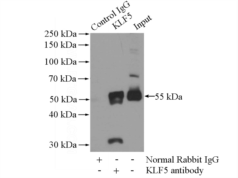 IP Result of anti-KLF5 (IP:Catalog No:112082, 4ug; Detection:Catalog No:112082 1:500) with HeLa cells lysate 2800ug.