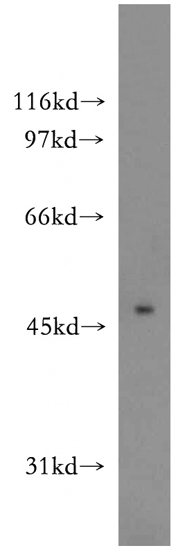mouse brain tissue were subjected to SDS PAGE followed by western blot with Catalog No:113912(PIP4K2A antibody) at dilution of 1:500