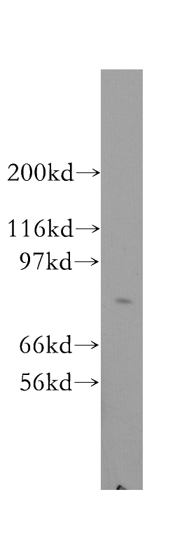HepG2 cells were subjected to SDS PAGE followed by western blot with Catalog No:109581(CRTC2,TORC2 antibody) at dilution of 1:300