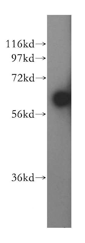 HepG2 cells were subjected to SDS PAGE followed by western blot with Catalog No:113407(NUCB1 antibody) at dilution of 1:500