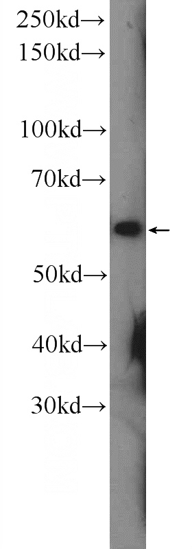 rat brain tissue were subjected to SDS PAGE followed by western blot with Catalog No:109282(CHRNA7 Antibody) at dilution of 1:600