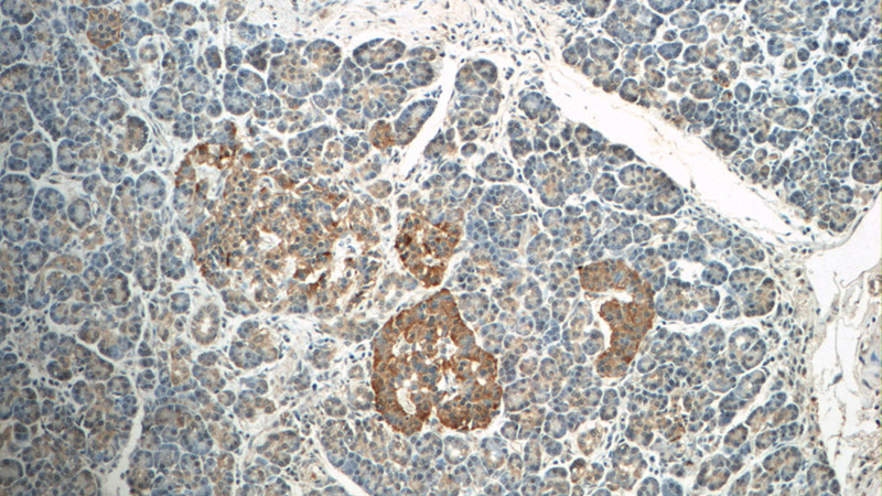 Immunohistochemistry of paraffin-embedded human pancreas tissue slide using Catalog No:109000(CCL18 Antibody) at dilution of 1:50 (under 10x lens)