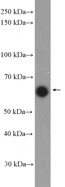 Jurkat cells were subjected to SDS PAGE followed by western blot with Catalog No:117056(ZIK1 Antibody) at dilution of 1:300