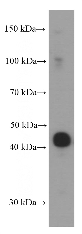 pig brain tissue were subjected to SDS PAGE followed by western blot with Catalog No:107368(L2HGDH Antibody) at dilution of 1:1000
