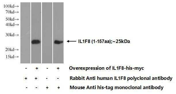 Transfected HEK-293 cells were subjected to SDS PAGE followed by western blot with Catalog No:111740(IL1F8 Antibody) at dilution of 1:700