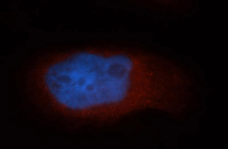 Immunofluorescent analysis of MCF-7 cells, using NDE1 antibody Catalog No:113053 at 1:50 dilution and Rhodamine-labeled goat anti-rabbit IgG (red). Blue pseudocolor = DAPI (fluorescent DNA dye).