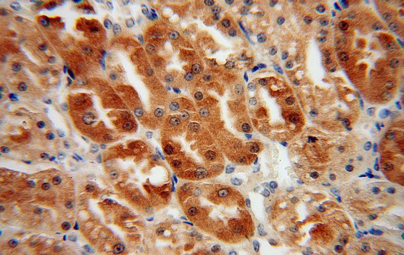 Immunohistochemical of paraffin-embedded human kidney using Catalog No:111707(TRMT2A antibody) at dilution of 1:50 (under 40x lens)