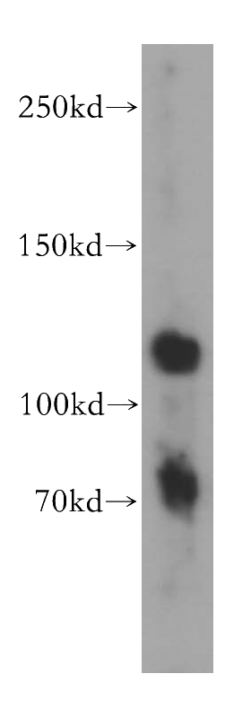mouse brain tissue were subjected to SDS PAGE followed by western blot with Catalog No:108021(APLP2 antibody) at dilution of 1:300