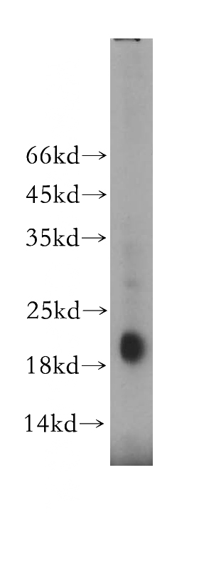 human liver tissue were subjected to SDS PAGE followed by western blot with Catalog No:112834(MRPL52 antibody) at dilution of 1:300