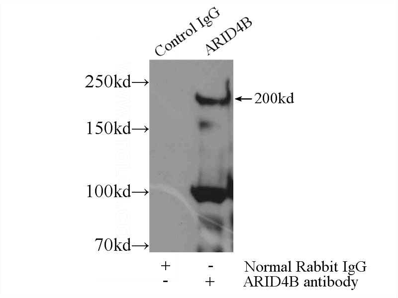 IP Result of anti-ARID4B (IP:Catalog No:108192, 5ug; Detection:Catalog No:108192 1:1000) with MCF-7 cells lysate 4000ug.