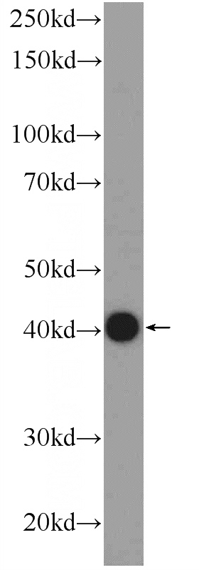 rat liver tissue were subjected to SDS PAGE followed by western blot with Catalog No:117141(BHMT2 Antibody) at dilution of 1:1000