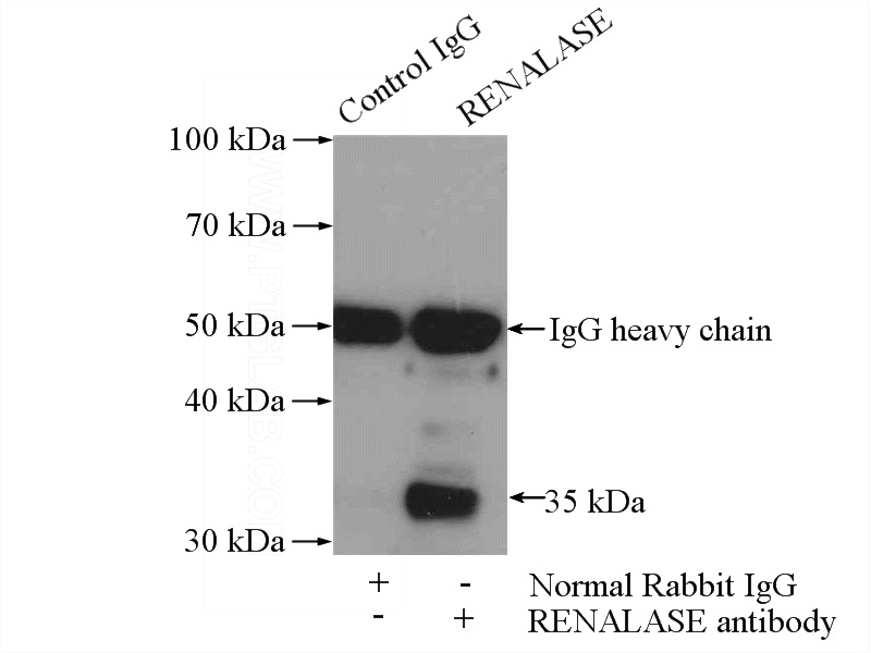 IP Result of anti-RENALASE (IP:Catalog No:114688, 4ug; Detection:Catalog No:114688 1:500) with HEK-293 cells lysate 2000ug.
