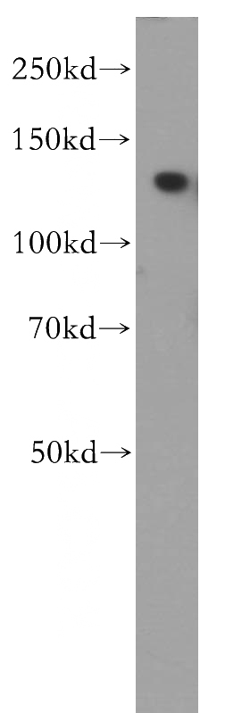 HeLa cells were subjected to SDS PAGE followed by western blot with Catalog No:113106(NEK9 antibody) at dilution of 1:500