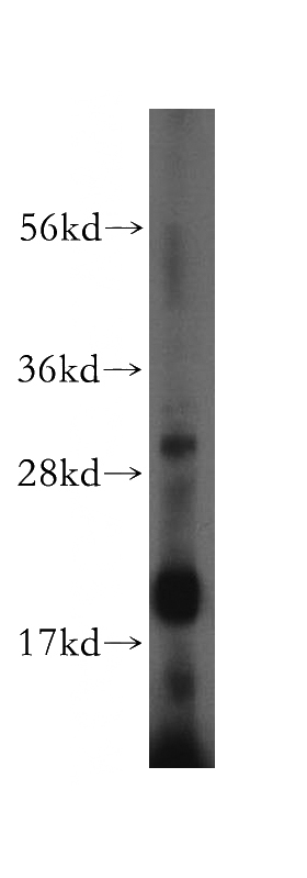 MCF7 cells were subjected to SDS PAGE followed by western blot with Catalog No:116236(TRAIL antibody) at dilution of 1:1000