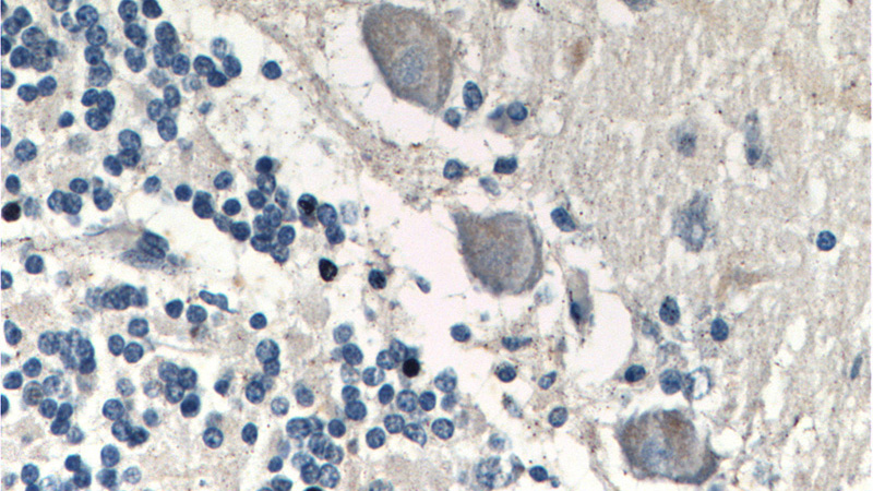Immunohistochemistry of paraffin-embedded human cerebellum tissue slide using Catalog No:116393(NTRK2 Antibody) at dilution of 1:200 (under 40x lens).