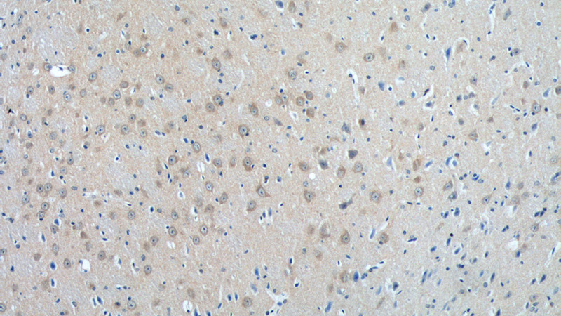 Immunohistochemistry of paraffin-embedded mouse brain tissue slide using Catalog No:113257(NMUR1 Antibody) at dilution of 1:50 (under 10x lens)