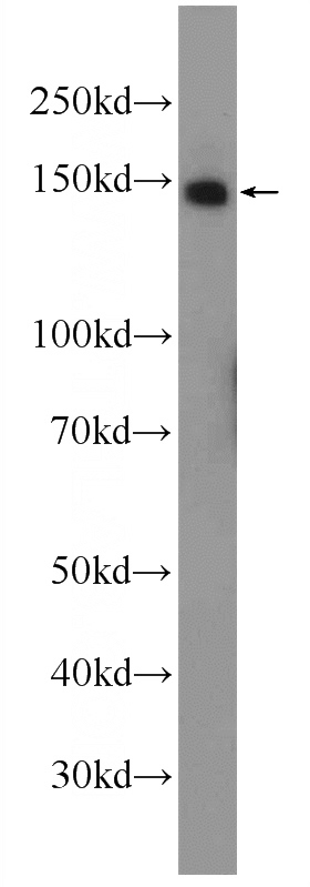 Jurkat cells were subjected to SDS PAGE followed by western blot with Catalog No:111399(HELB Antibody) at dilution of 1:1000