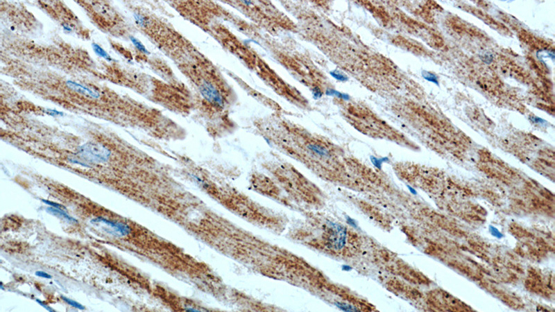 Immunohistochemical of paraffin-embedded human heart using Catalog No:107071(ATP5A1 antibody) at dilution of 1:50 (under 40x lens)