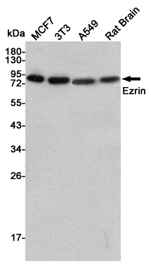 Western blot detection of Ezrin in MCF7,3T3,A549 and Rat Brain lysates using Ezrin mouse mAb(dilution 1:1000).Predicted band size:69kDa.Observed band size:81kDa.