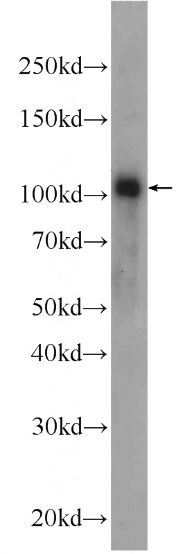 mouse brain tissue were subjected to SDS PAGE followed by western blot with Catalog No:110554(FBXO41 Antibody) at dilution of 1:1500