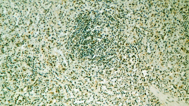 Immunohistochemical of paraffin-embedded human spleen using Catalog No:111650(IKZF3 antibody) at dilution of 1:100 (under 10x lens)