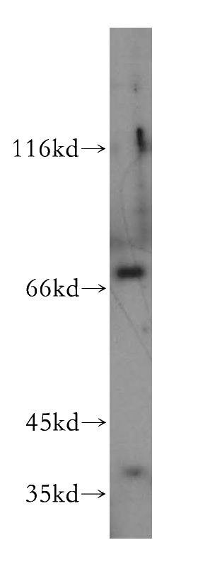 HeLa cells were subjected to SDS PAGE followed by western blot with Catalog No:112356(LSS antibody) at dilution of 1:500