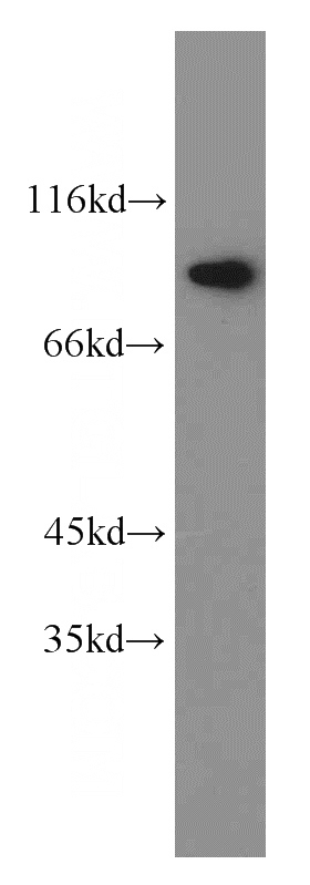 HEK-293 cells were subjected to SDS PAGE followed by western blot with Catalog No:111521(HOOK1 antibody) at dilution of 1:600