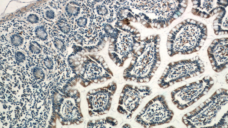 Immunohistochemistry of paraffin-embedded human small intestine tissue slide using Catalog No:107320(NAPRT1 Antibody) at dilution of 1:50 (under 10x lens)