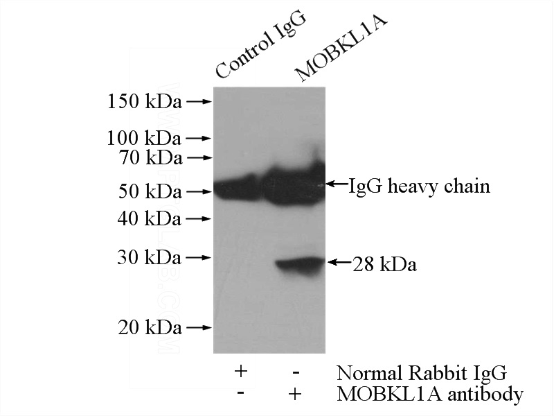 IP Result of anti-MOBKL1A (IP:Catalog No:112719, 4ug; Detection:Catalog No:112719 1:1000) with Jurkat cells lysate 2800ug.