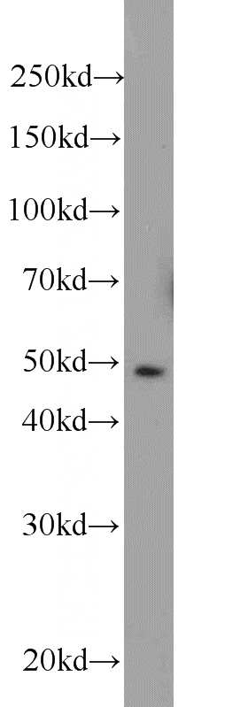 HeLa cells were subjected to SDS PAGE followed by western blot with Catalog No:112621(MIG6; ERRFI1 antibody) at dilution of 1:1000