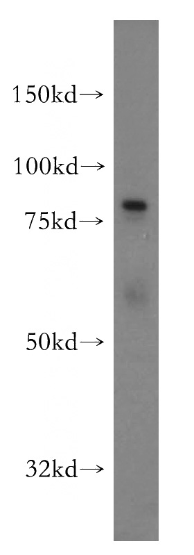 HeLa cells were subjected to SDS PAGE followed by western blot with Catalog No:113771(PFKL antibody) at dilution of 1:500