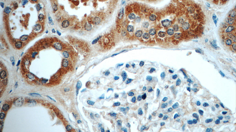 Immunohistochemistry of paraffin-embedded human kidney tissue slide using Catalog No:116100(TMEM154 Antibody) at dilution of 1:50 (under 40x lens)