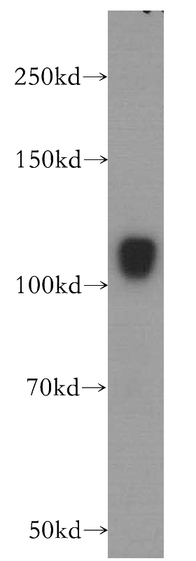human brain tissue were subjected to SDS PAGE followed by western blot with Catalog No:111993(KIAA1468 antibody) at dilution of 1:500