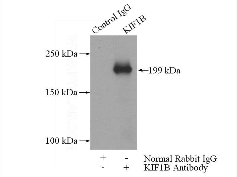 IP Result of anti-KIF1B (IP:Catalog No:112004, 5ug; Detection:Catalog No:112004 1:700) with HeLa cells lysate 2000ug.