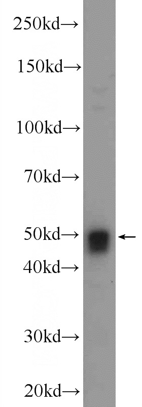 HEK-293 cells were subjected to SDS PAGE followed by western blot with Catalog No:115455(SNRNP48 Antibody) at dilution of 1:1000