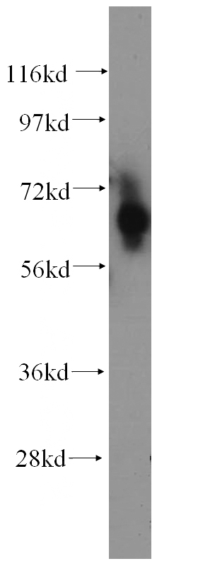 Jurkat cells were subjected to SDS PAGE followed by western blot with Catalog No:109175(CDT1 antibody) at dilution of 1:500