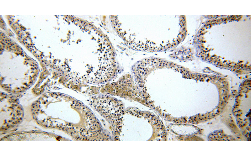 Immunohistochemical of paraffin-embedded human testis using Catalog No:112089(KLHL12 antibody) at dilution of 1:100 (under 10x lens)