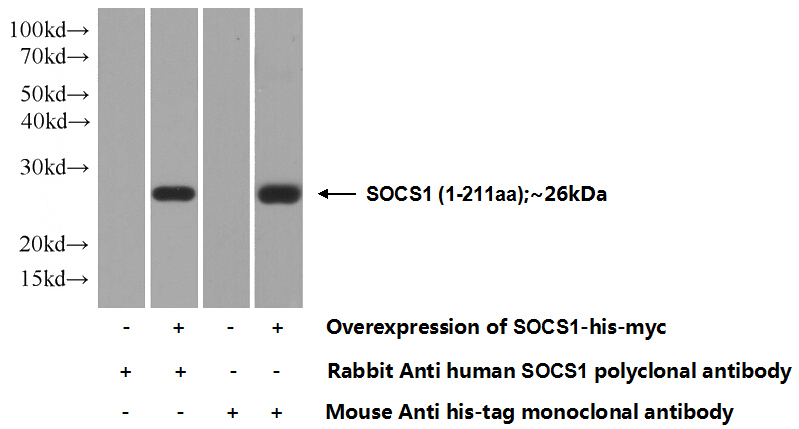 Transfected HEK-293 cells were subjected to SDS PAGE followed by western blot with Catalog No:115488(SocS1 Antibody) at dilution of 1:1000