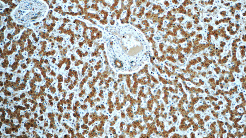 Immunohistochemistry of paraffin-embedded human liver tissue slide using Catalog No:113819(PHKA2 Antibody) at dilution of 1:50 (under 10x lens)