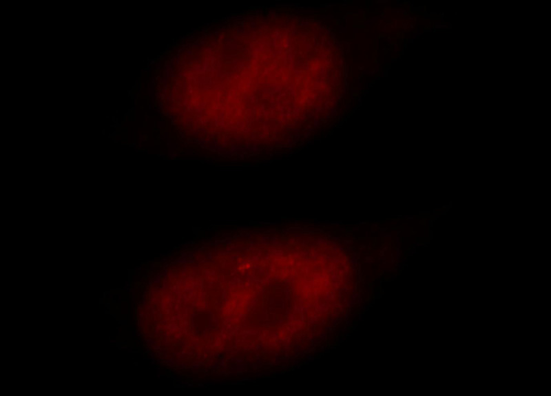 Immunofluorescent analysis of Hela cells, using RBM16 antibody Catalog No:114601 at 1:25 dilution and Rhodamine-labeled goat anti-rabbit IgG (red).