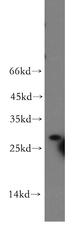 BxPC-3 cells were subjected to SDS PAGE followed by western blot with Catalog No:115790(STX10 antibody) at dilution of 1:200