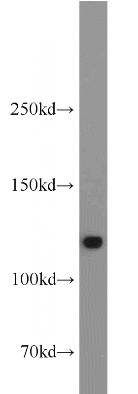 Jurkat cells were subjected to SDS PAGE followed by western blot with Catalog No:109928(DHX16 antibody) at dilution of 1:1000