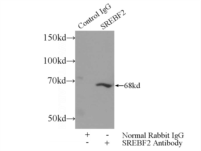 IP Result of anti-SREBF2 (IP:Catalog No:115582, 3ug; Detection:Catalog No:115582 1:500) with HeLa cells lysate 3000ug.