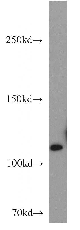 human testis tissue were subjected to SDS PAGE followed by western blot with Catalog No:116588(USP11 antibody) at dilution of 1:1000