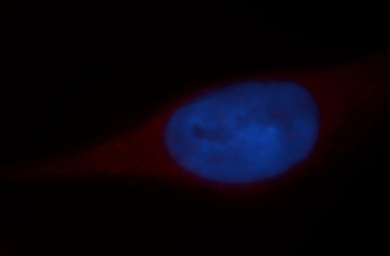 Immunofluorescent analysis of Hela cells, using DDX3Y antibody Catalog No:109829 at 1:25 dilution and Rhodamine-labeled goat anti-rabbit IgG (red). Blue pseudocolor = DAPI (fluorescent DNA dye).