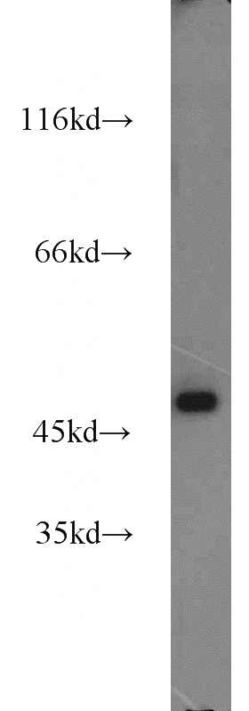 HeLa cells were subjected to SDS PAGE followed by western blot with Catalog No:107870(GLA antibody) at dilution of 1:1000