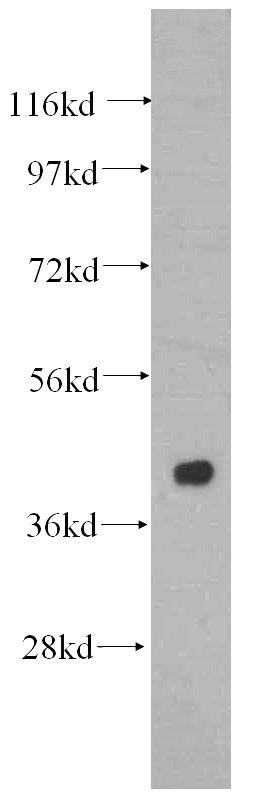 mouse brain tissue were subjected to SDS PAGE followed by western blot with Catalog No:107676(AARSD1 antibody) at dilution of 1:500