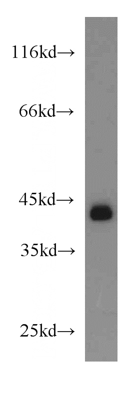 K-562 cells were subjected to SDS PAGE followed by western blot with Catalog No:115925(TARDBP antibody) at dilution of 1:2000